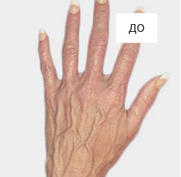 hands-img-1.jpg