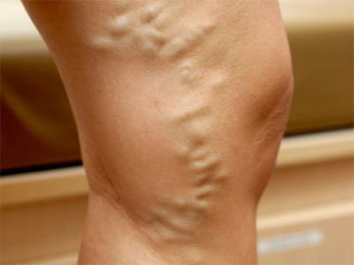 Подкожные вены